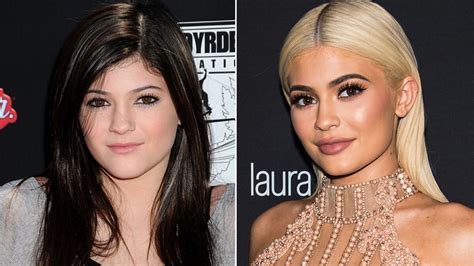 kylie jenner vorher nachher bilder|Kylie Jenners krasse Beauty